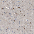 Immunohistochemical staining of human cerebral cortex shows strong cytoplasmic positivity in glial cells.