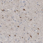 Immunohistochemical staining of human cerebral cortex shows strong cytoplasmic positivity in glial cells.