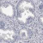 Immunohistochemical staining of human prostate shows no positivity in glandular cells as expected.