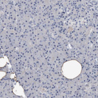 Immunohistochemical staining of human pancreas shows no positivity in exocrine glandular cells as expected.