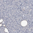 Immunohistochemical staining of human pancreas shows no positivity in exocrine glandular cells as expected.
