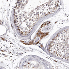 Anti-SLC10A4 Antibody