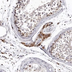 Immunohistochemical staining of human testis shows moderate to strong cytoplasmic positivity in Leydig cells.