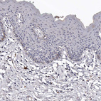 Anti-SLC10A4 Antibody