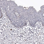 Immunohistochemical staining of human skin shows no positivity in epidermal cells.