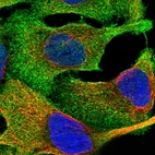 Immunofluorescent staining of human cell line U-2 OS shows localization to plasma membrane.