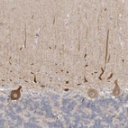 Immunohistochemical staining of human cerebellum shows positivity in Purkinje cells, including processes.