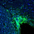 Immunofluorescence staining of mouse rostral migratory stream shows strong immunoreactivity in the subventricular zone.