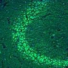Immunofluorescence staining of mouse hippocampus shows labeling of the CA3 neurons and their dendrites.