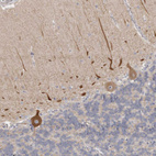 Immunohistochemical staining of human cerebellum shows cytoplasmic immunoreactivity in Purkinje cells.