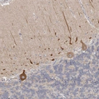 Immunohistochemical staining of human cerebellum shows cytoplasmic immunoreactivity in Purkinje cells.
