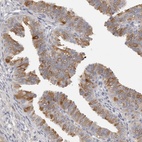 Immunohistochemical staining of human fallopian tube shows strong positivity in a subset of glandular cells.