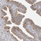 Immunohistochemical staining of human fallopian tube shows strong positivity in a subset of glandular cells.