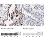 Anti-TFAP2A Antibody