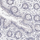 Immunohistochemical staining of human colon shows low expression as expected.