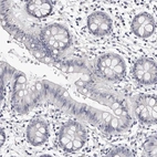 Immunohistochemical staining of human colon shows low expression as expected.