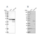 Western blot analysis using Anti-TFAP2A antibody HPA028850 (A) shows similar pattern to independent antibody HPA056871 (B).