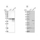 Western blot analysis using Anti-TFAP2A antibody HPA028850 (A) shows similar pattern to independent antibody HPA056871 (B).