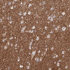 Anti-PACSIN1 Antibody