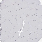 Immunohistochemical staining of human skeletal muscle shows low expression as expected.