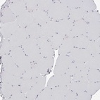 Anti-PACSIN1 Antibody