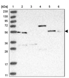 Lane 1: Marker [kDa] 230, 130, 95, 72, 56, 36, 28, 17, 11_br/_Lane 2: Human cell line RT-4_br/_Lane 3: Human cell line U-251MG sp_br/_Lane 4: Human plasma (IgG/HSA depleted)_br/_Lane 5: Human liver tissue_br/_Lane 6: Human tonsil tissue