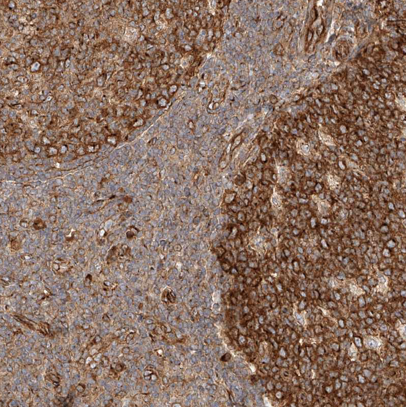 Anti-NAP1L1 Antibody