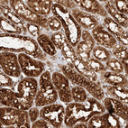 Immunohistochemical staining of human kidney shows strong cytoplasmic positivity in cells in tubules.