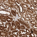 Immunohistochemical staining of human kidney shows strong cytoplasmic positivity in cells in tubules.