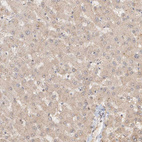 Immunohistochemical staining of human liver shows weak cytoplasmic positivity in hepatocytes as expected.
