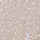 Immunohistochemical staining of human liver shows weak cytoplasmic positivity in hepatocytes as expected.