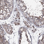 Anti-ELK4 Antibody