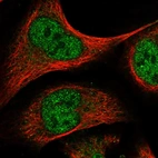 Immunofluorescent staining of human cell line U-2 OS shows localization to nucleoplasm.