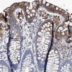 Anti-UBOX5 Antibody