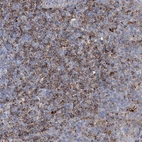 Immunohistochemical staining of human tonsil shows strong cytoplasmic-membranous positivity in non-germinal center cells.