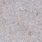 Immunohistochemical staining of human cerebral cortex shows moderate cytoplasmic positivity in neuropil.