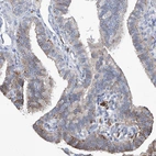 Immunohistochemical staining of human fallopian tube shows moderate cytoplasmic positivity in non-ciliated cells.