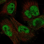 Immunofluorescent staining of human cell line U-251 MG shows localization to nucleoplasm.