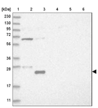 Lane 1: Marker [kDa] 230, 130, 95, 72, 56, 36, 28, 17, 11_br/_Lane 2: Human cell line RT-4_br/_Lane 3: Human cell line U-251MG sp_br/_Lane 4: Human plasma (IgG/HSA depleted)_br/_Lane 5: Human liver tissue_br/_Lane 6: Human tonsil tissue