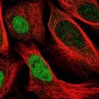 Immunofluorescent staining of human cell line U-2 OS shows localization to nucleoplasm.