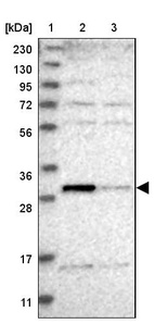 Lane 1: Marker [kDa] 230, 130, 95, 72, 56, 36, 28, 17, 11_br/_Lane 2: Human cell line RT-4_br/_Lane 3: Human cell line U-251MG sp