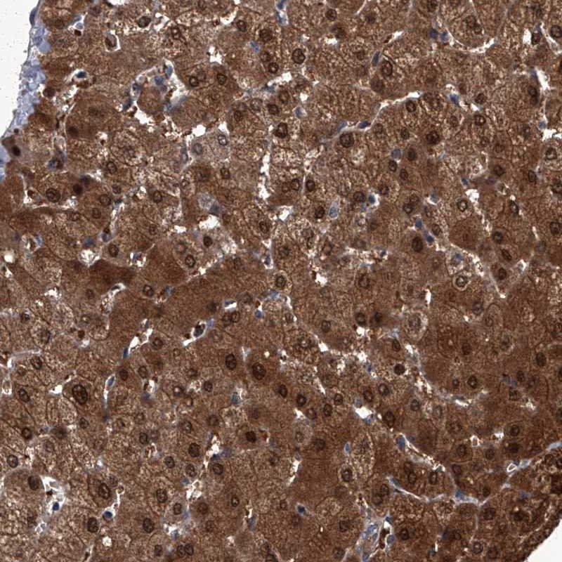 Anti-ZNF274 Antibody