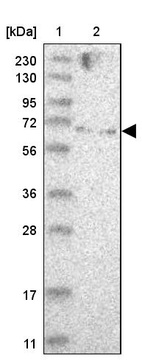 Lane 1: Marker [kDa] 230, 130, 95, 72, 56, 36, 28, 17, 11_br/_Lane 2: Human cell line RT-4