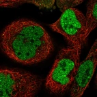 Immunofluorescent staining of human cell line A-431 shows localization to nucleoplasm.