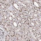 Immunohistochemical staining of human kidney shows moderate nuclear positivity in cells in tubules.