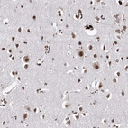Immunohistochemical staining of human cerebral cortex shows strong nuclear positivity in neurons.