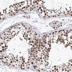 Immunohistochemical staining of human testis shows strong nuclear positivity in cells in seminiferous ducts.