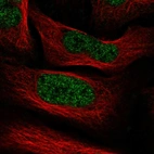 Immunofluorescent staining of human cell line U-2 OS shows localization to nucleoplasm.
