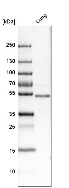 Anti-FOXF1 Antibody
