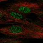 Immunofluorescent staining of human cell line BJ shows localization to nucleoplasm.